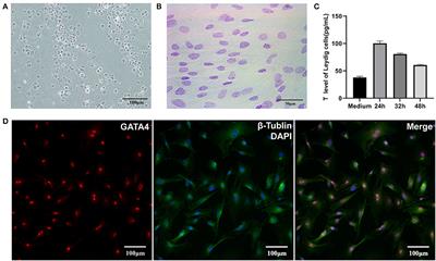 Transcriptome sequencing reveals differences between leydig cells and sertoli cells of yak